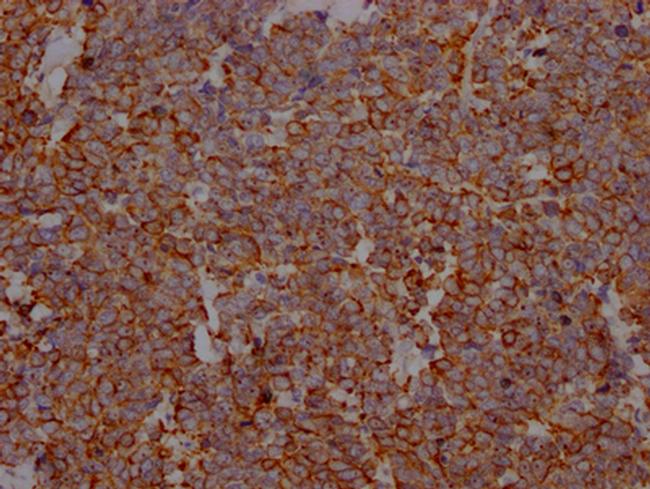 PD-L1 Antibody in Immunohistochemistry (Paraffin) (IHC (P))