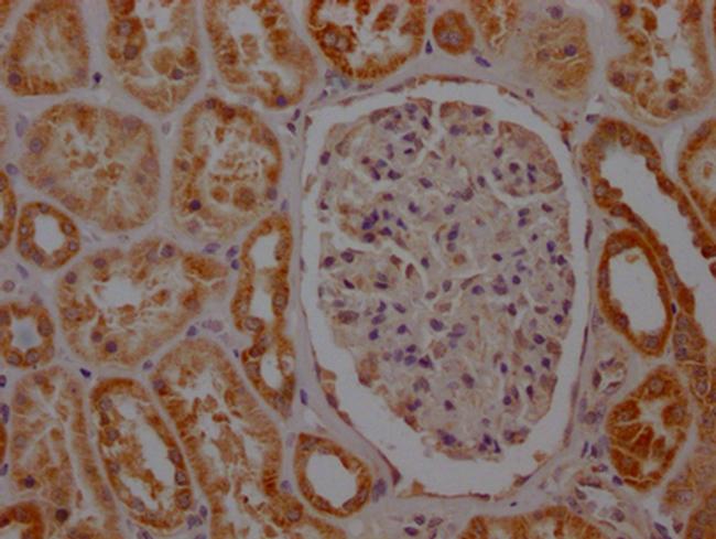 SDHB Antibody in Immunohistochemistry (Paraffin) (IHC (P))