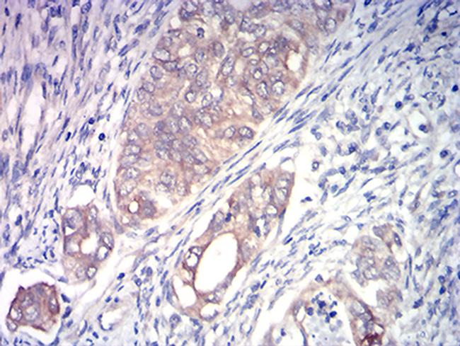 ACSS1 Antibody in Immunohistochemistry (Paraffin) (IHC (P))