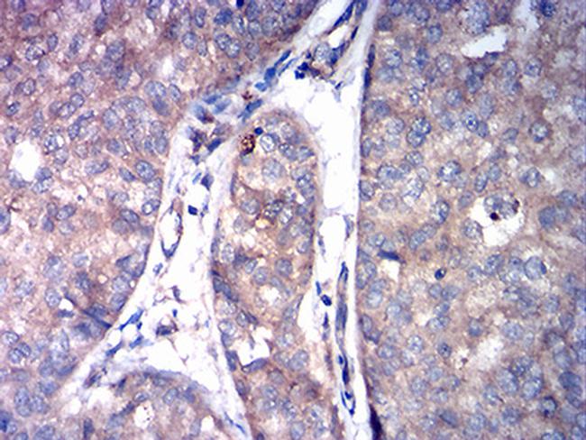 ASGR2 Antibody in Immunohistochemistry (Paraffin) (IHC (P))