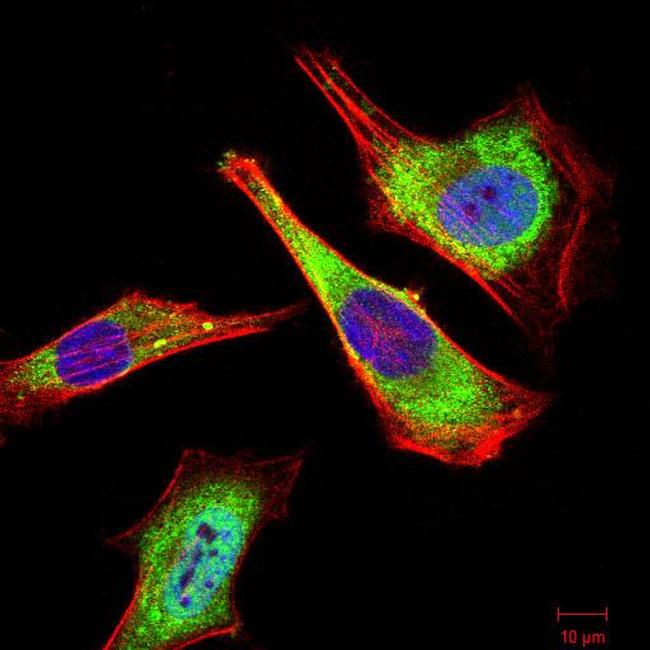 ATG5 Antibody in Immunocytochemistry (ICC/IF)