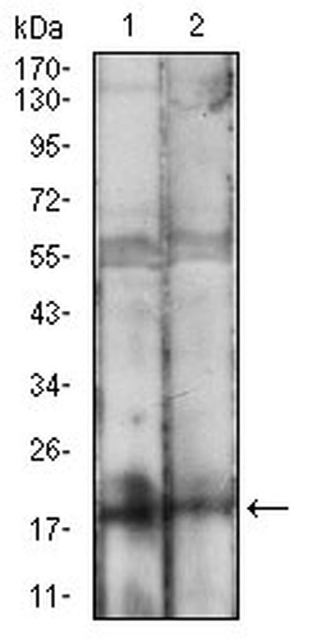 BAD Antibody in Western Blot (WB)