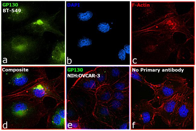 GP130 Antibody in Immunocytochemistry (ICC/IF)