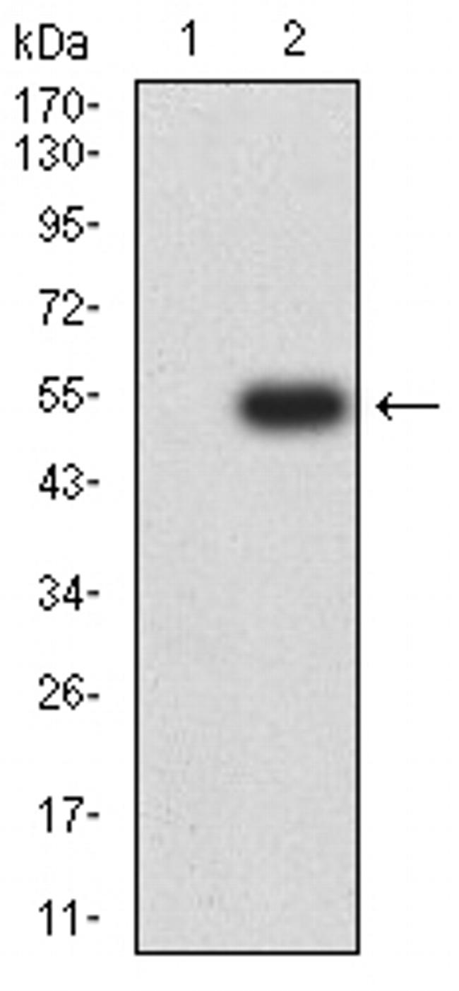 CHD4 Antibody in Western Blot (WB)