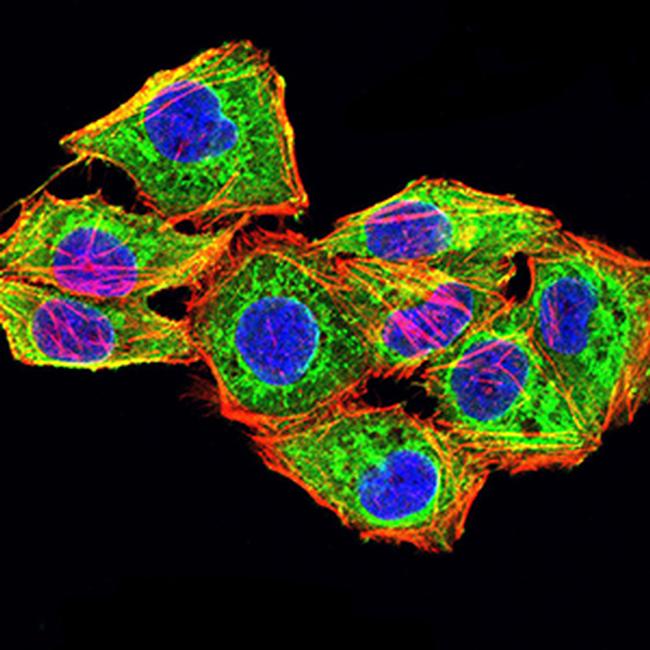 Calponin 3 Antibody in Immunocytochemistry (ICC/IF)