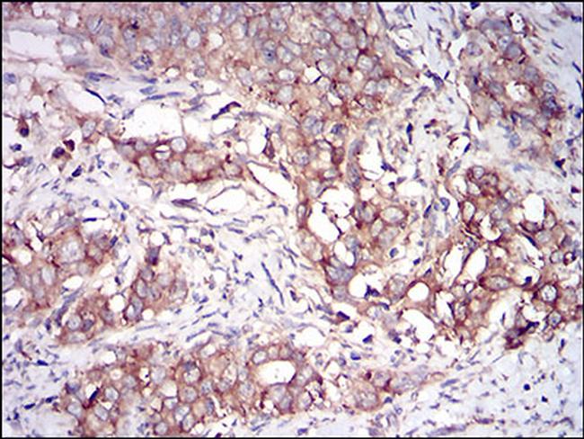 PKR Antibody in Immunohistochemistry (Paraffin) (IHC (P))