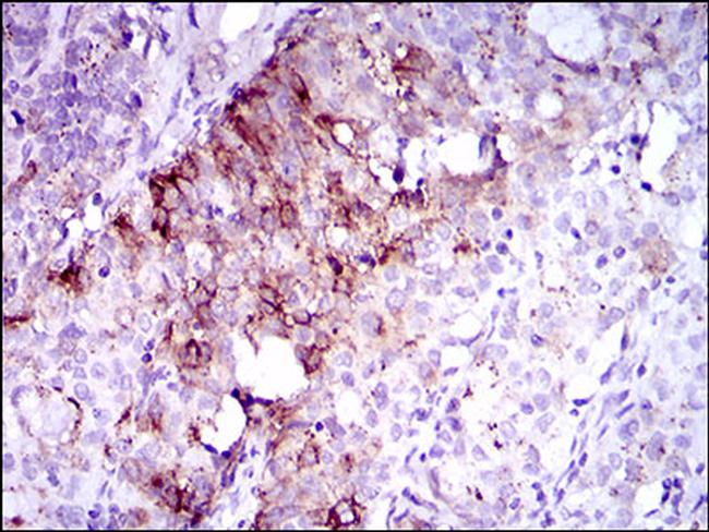 FLT3 Antibody in Immunohistochemistry (Paraffin) (IHC (P))