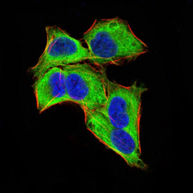 GLI1 Antibody in Immunocytochemistry (ICC/IF)