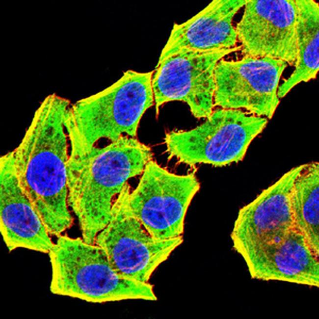 GSTP1 Antibody in Immunocytochemistry (ICC/IF)