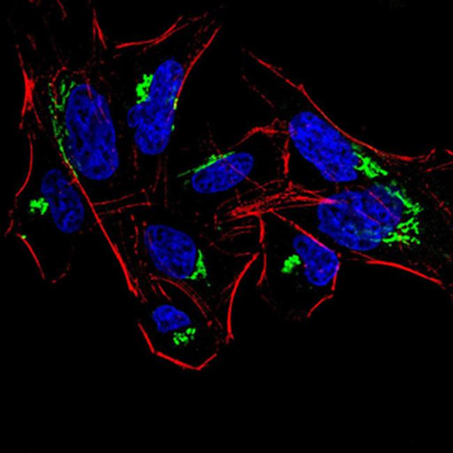 HDAC4 Antibody in Immunocytochemistry (ICC/IF)