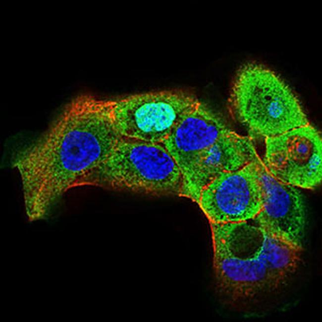 HSF1 Antibody in Immunocytochemistry (ICC/IF)