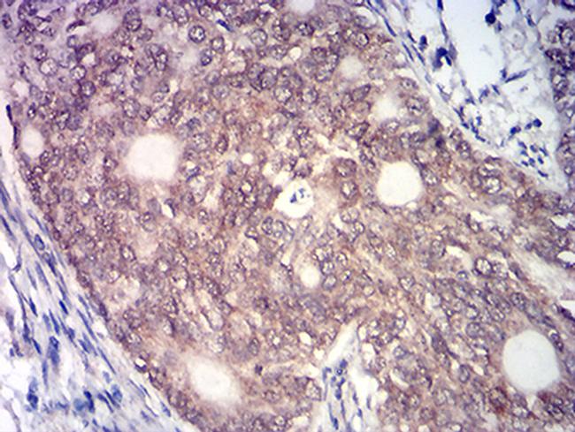 MYST2 Antibody in Immunohistochemistry (Paraffin) (IHC (P))