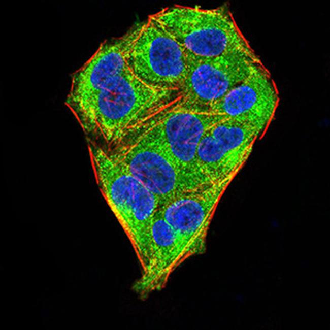 MECP2 Antibody in Immunocytochemistry (ICC/IF)