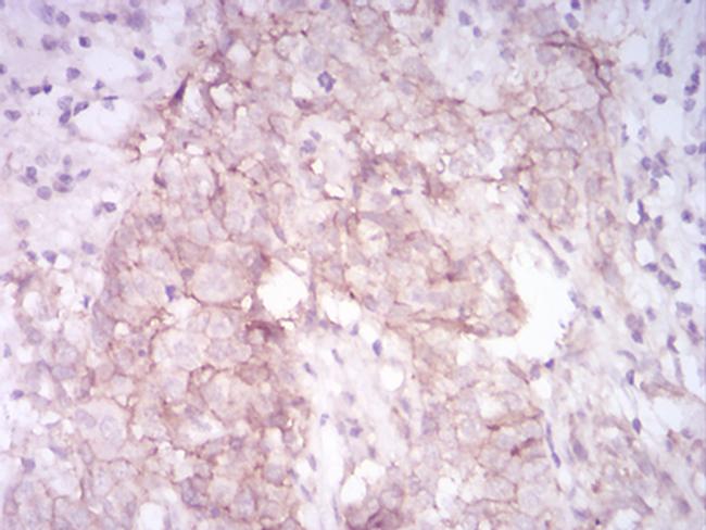 MMP14 Antibody in Immunohistochemistry (Paraffin) (IHC (P))