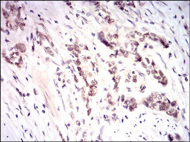 Nrf2 Antibody in Immunohistochemistry (Paraffin) (IHC (P))