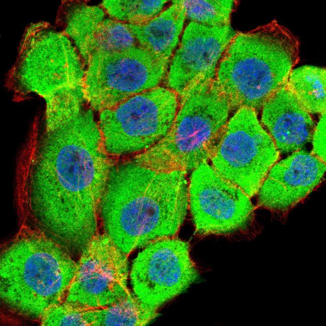 RSK3 Antibody in Immunocytochemistry (ICC/IF)