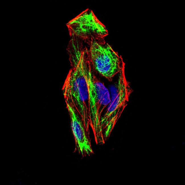 SLUG Antibody in Immunocytochemistry (ICC/IF)