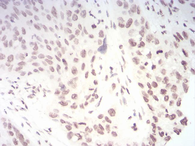 TERT Antibody in Immunohistochemistry (Paraffin) (IHC (P))