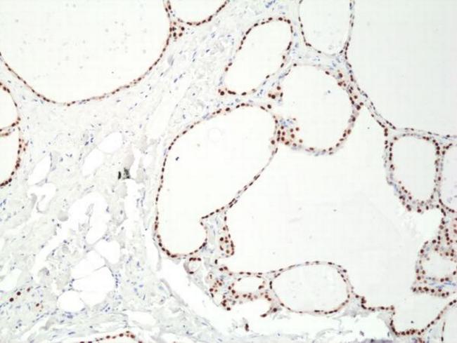 PAX8 Antibody in Immunohistochemistry (Paraffin) (IHC (P))