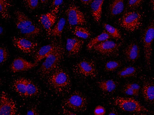 Angiopoietin 2 Antibody in Immunocytochemistry (ICC/IF)