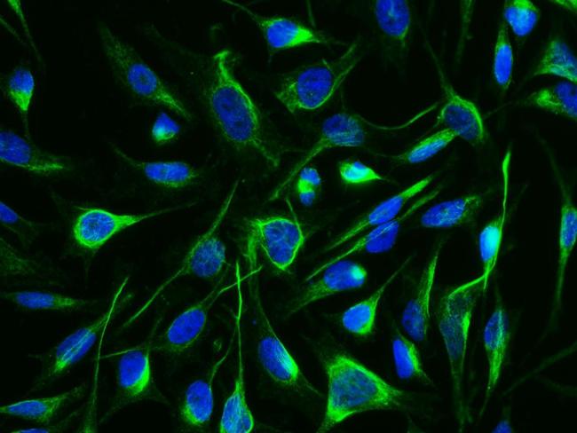 Arginase 1 Antibody in Immunocytochemistry (ICC/IF)