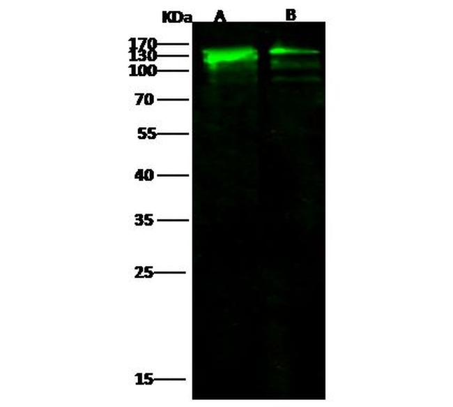 E-cadherin Antibody in Western Blot (WB)