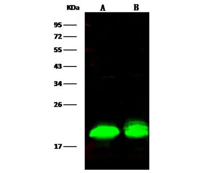 4EBP1 Antibody in Western Blot (WB)