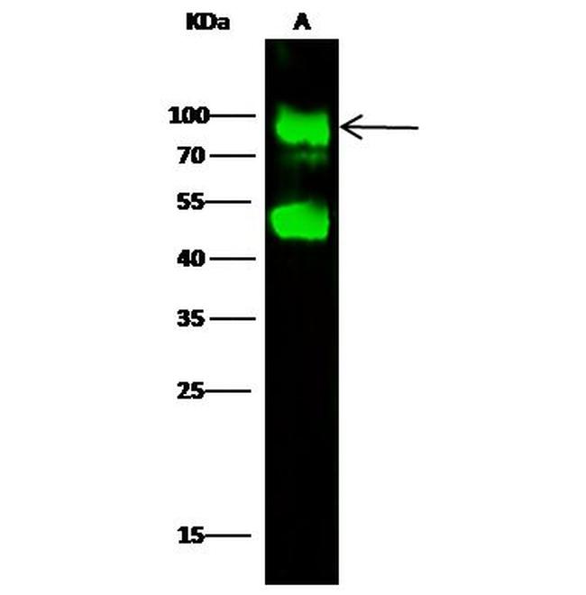 GNS Antibody in Western Blot (WB)