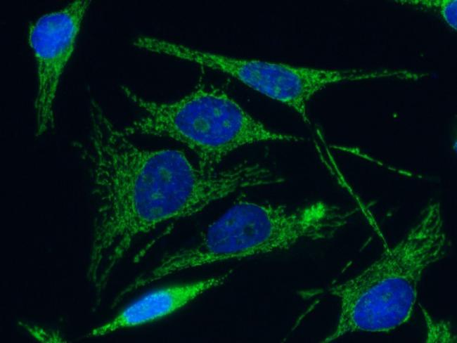 C1QBP Antibody in Immunocytochemistry (ICC/IF)