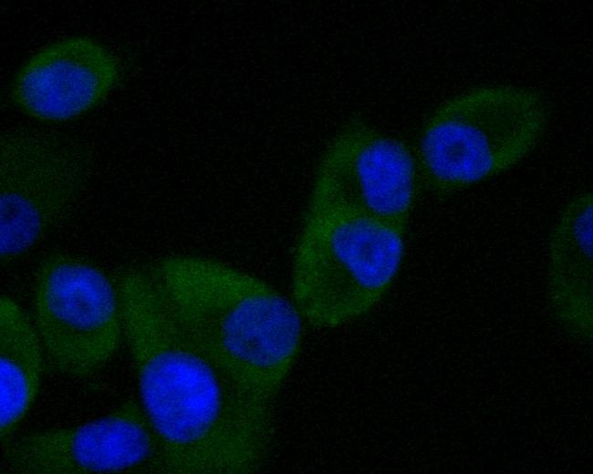 SV2B Antibody in Immunocytochemistry (ICC/IF)