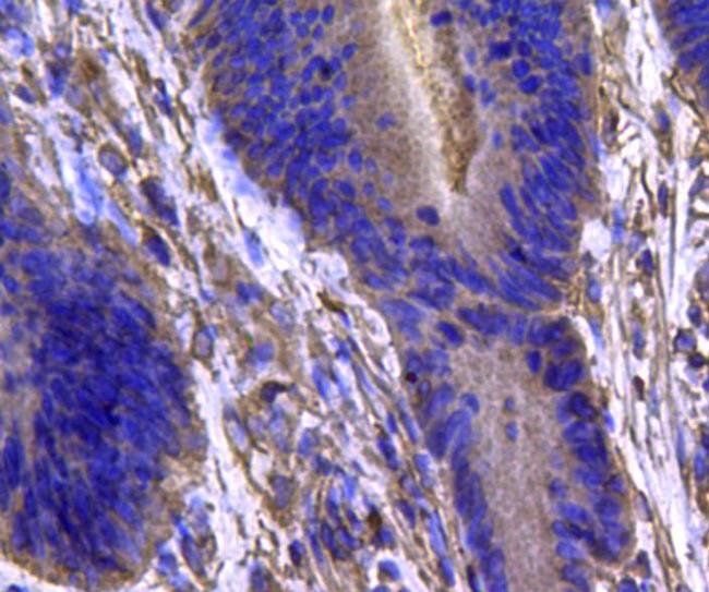 IDH1 Antibody in Immunohistochemistry (Paraffin) (IHC (P))