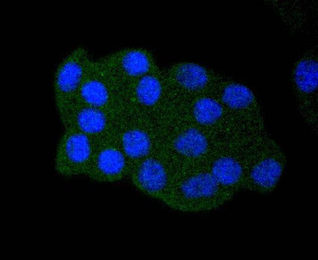 Acetyl-p53 (Lys382) Antibody in Immunocytochemistry (ICC/IF)