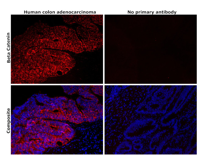 beta Catenin Antibody in Immunohistochemistry (Paraffin) (IHC (P))