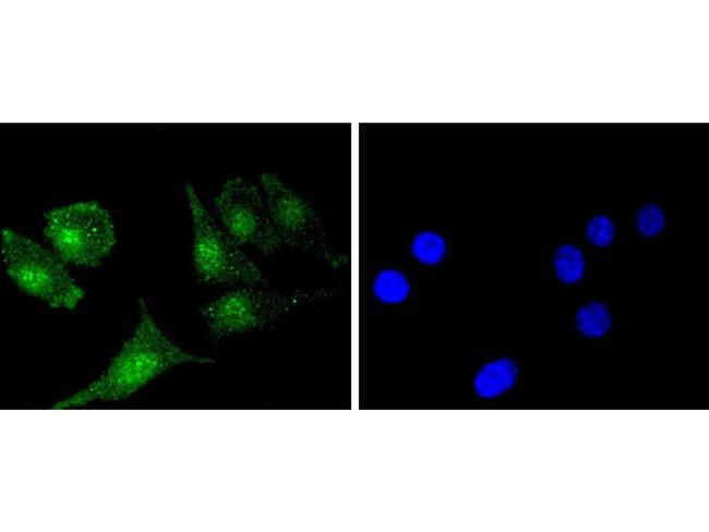 Bcl-2 Antibody in Immunocytochemistry (ICC/IF)