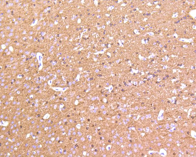 Tau Antibody in Immunohistochemistry (Paraffin) (IHC (P))