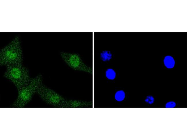 ERK1 Antibody in Immunocytochemistry (ICC/IF)