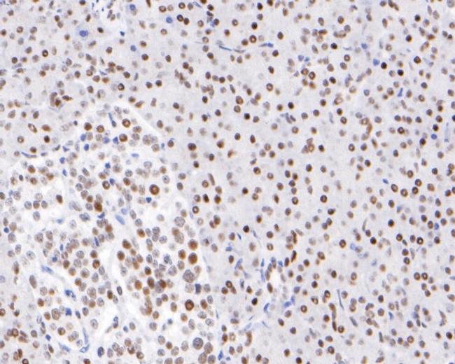 HDAC1 Antibody in Immunohistochemistry (Paraffin) (IHC (P))