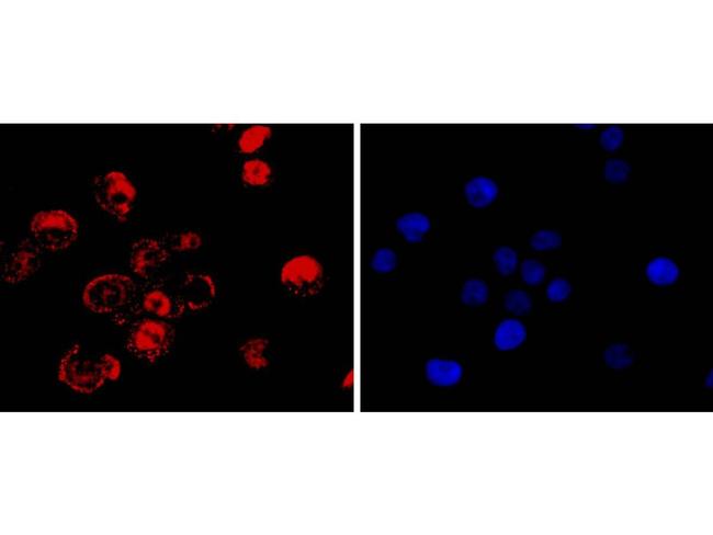 CDX2 Antibody in Immunocytochemistry (ICC/IF)