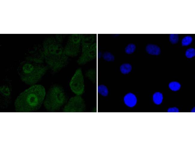 MSI1 Antibody in Immunocytochemistry (ICC/IF)