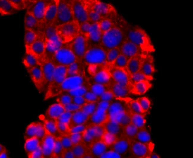 Synaptophysin Antibody in Immunocytochemistry (ICC/IF)