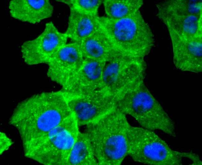 Alpha-Smooth Muscle Actin Antibody in Immunocytochemistry (ICC/IF)