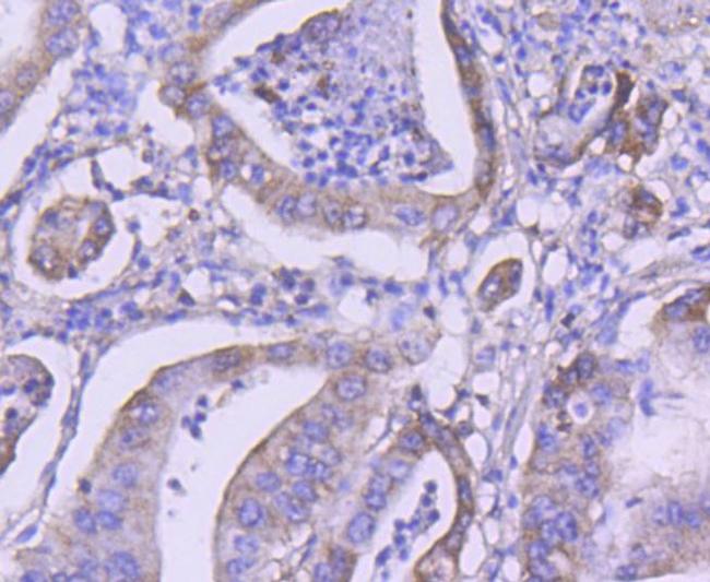 VPS34 Antibody in Immunohistochemistry (Paraffin) (IHC (P))