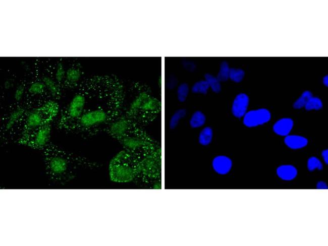 PARP1 Antibody in Immunocytochemistry (ICC/IF)