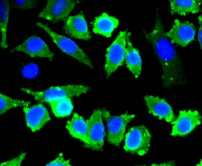 Stathmin 1 Antibody in Immunocytochemistry (ICC/IF)