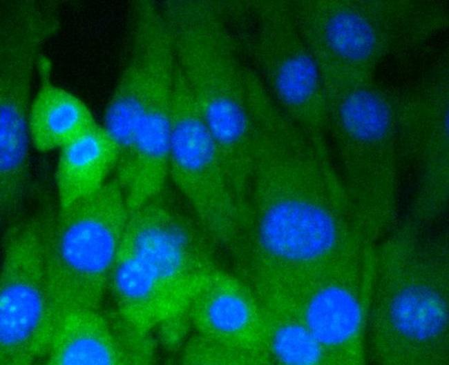 DNMT3A Antibody in Immunocytochemistry (ICC/IF)