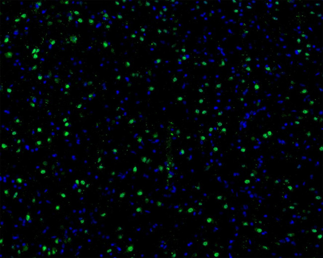 AKT1 Antibody in Immunocytochemistry (ICC/IF)