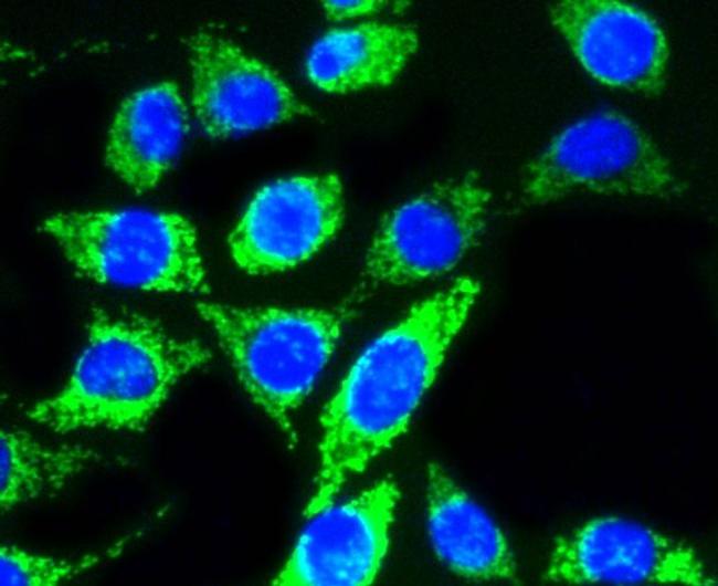 AKT Pan Antibody in Immunocytochemistry (ICC/IF)