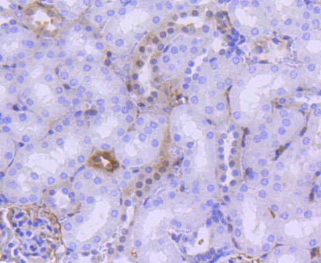 Phospho-YAP1 (Ser127) Antibody in Immunohistochemistry (Paraffin) (IHC (P))