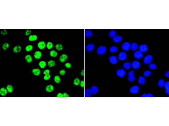 PIM1 Antibody in Immunocytochemistry (ICC/IF)