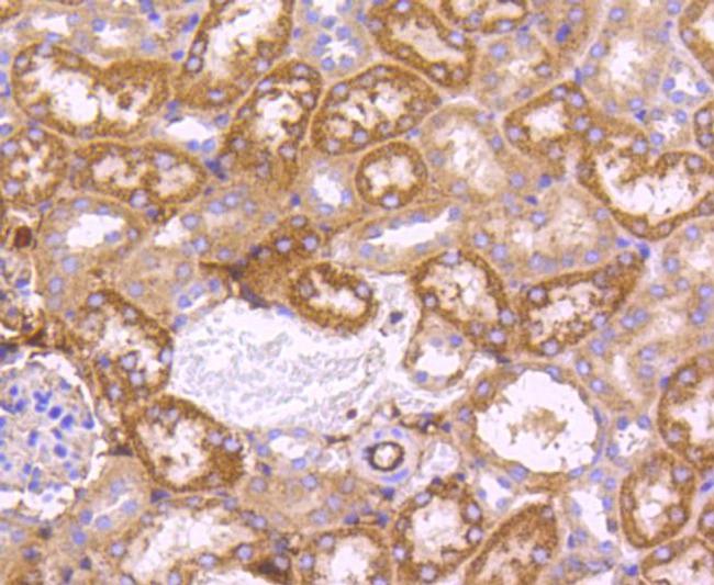 SGK1 Antibody in Immunohistochemistry (Paraffin) (IHC (P))